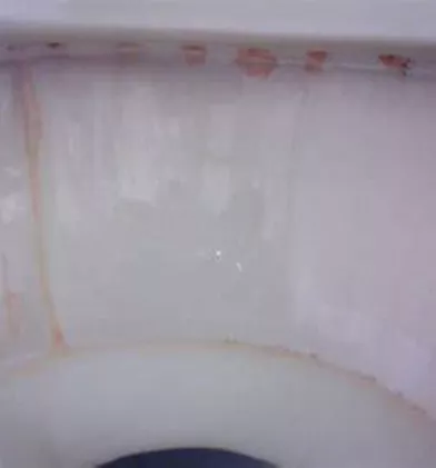 pink bacteria stain